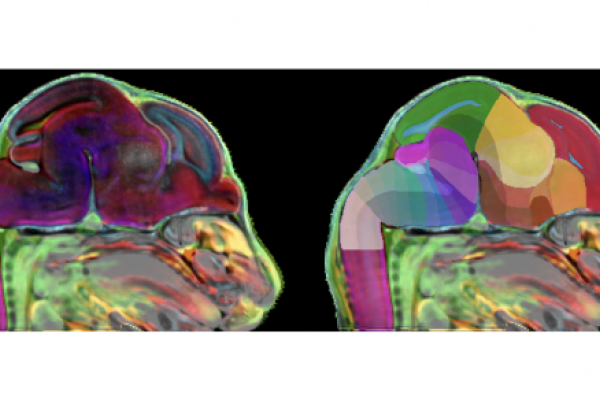 An image of a mouse brain